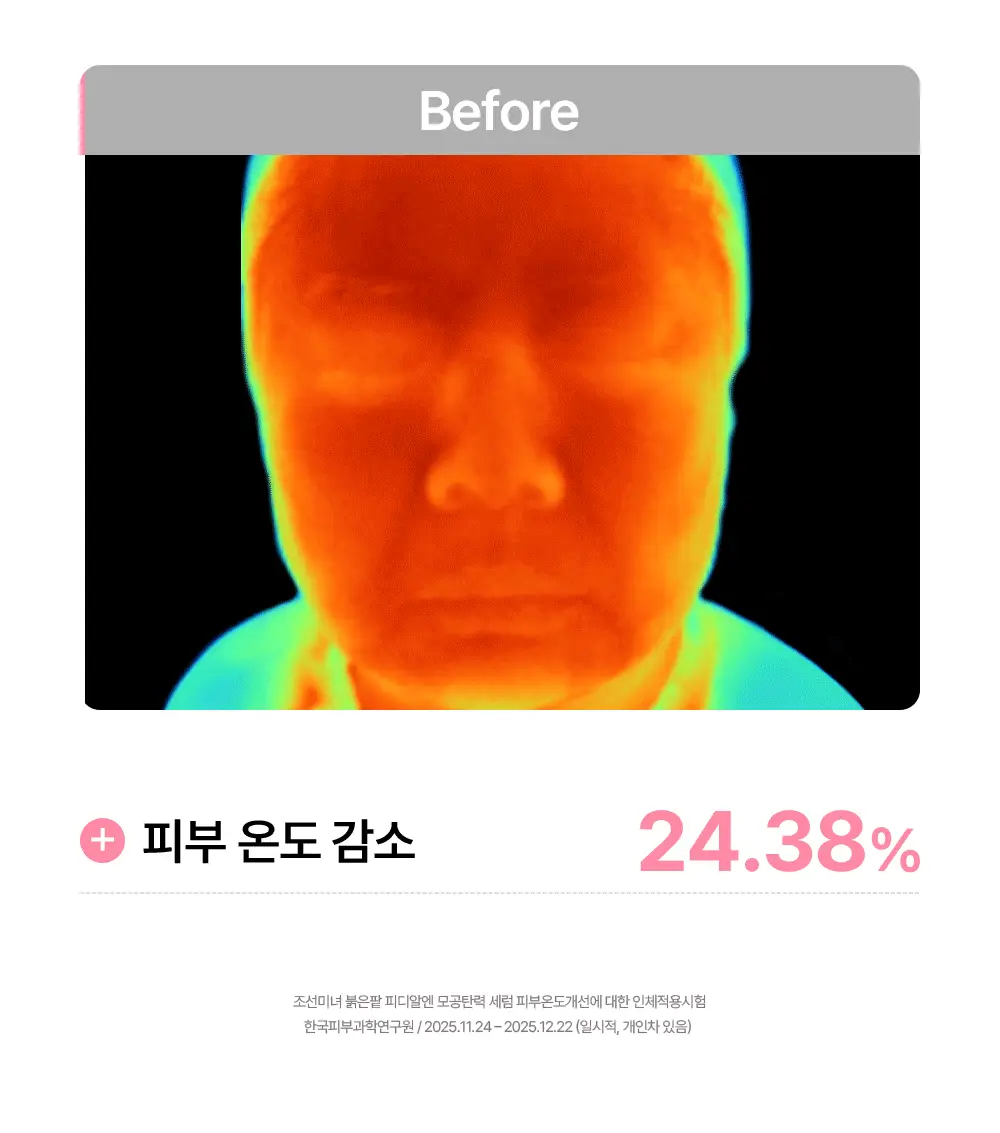 [NEW/붓기완화] 조선미녀 붉은팥 PDRN 모공탄력 세럼 30ml 상세페이지 25